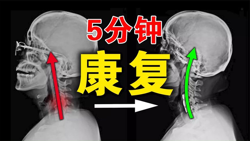 【颈椎康复训练】每天5分钟，改善颈椎僵硬不适，预防颈椎病